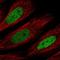CCAAT Enhancer Binding Protein Delta antibody, HPA067581, Atlas Antibodies, Immunofluorescence image 