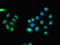 CEP215 antibody, LS-C677467, Lifespan Biosciences, Immunofluorescence image 