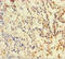 Dihydrofolate Reductase antibody, LS-C369534, Lifespan Biosciences, Immunohistochemistry paraffin image 
