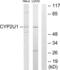 Cytochrome P450 Family 2 Subfamily U Member 1 antibody, LS-B9673, Lifespan Biosciences, Western Blot image 