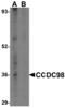 Abraxas 1, BRCA1 A Complex Subunit antibody, MBS151063, MyBioSource, Western Blot image 