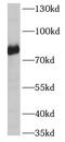 Scavenger Receptor Class F Member 1 antibody, FNab07624, FineTest, Western Blot image 