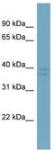 Chromosome X Open Reading Frame 66 antibody, TA336102, Origene, Western Blot image 