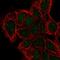 Diphthamide Biosynthesis 2 antibody, HPA045796, Atlas Antibodies, Immunocytochemistry image 