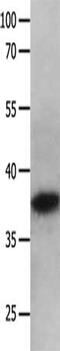 Mitogen-Activated Protein Kinase 10 antibody, CSB-PA950615, Cusabio, Western Blot image 