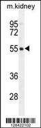 F-Box Protein 47 antibody, 55-792, ProSci, Western Blot image 
