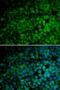 E3 ubiquitin-protein ligase TRIM13 antibody, MBS129792, MyBioSource, Immunofluorescence image 
