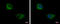 Keratin 71 antibody, GTX107343, GeneTex, Immunocytochemistry image 