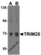 Tripartite Motif Containing 25 antibody, 4317, ProSci, Western Blot image 