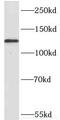 Lysine Demethylase 2A antibody, FNab04509, FineTest, Western Blot image 