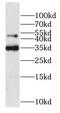 Dystrobrevin Binding Protein 1 antibody, FNab02595, FineTest, Western Blot image 