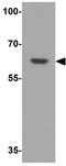 Mex-3 RNA Binding Family Member B antibody, GTX32049, GeneTex, Western Blot image 
