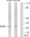 Homeobox protein SIX6 antibody, LS-C118736, Lifespan Biosciences, Western Blot image 