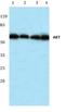 Protein kinase B antibody, AP06490PU-N, Origene, Western Blot image 