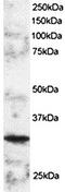Forkhead Box D1 antibody, orb18407, Biorbyt, Western Blot image 