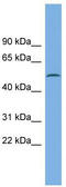 Calcium/Calmodulin Dependent Protein Kinase IG antibody, TA344779, Origene, Western Blot image 