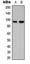 1-Acylglycerol-3-Phosphate O-Acyltransferase 1 antibody, orb304544, Biorbyt, Western Blot image 