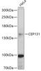 5-azacytidine-induced protein 1 antibody, 18-025, ProSci, Western Blot image 