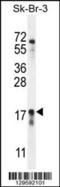Chromosome 1 Open Reading Frame 115 antibody, 55-894, ProSci, Western Blot image 