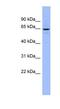 Sodium-dependent phosphate transport protein 2C antibody, NBP1-79995, Novus Biologicals, Western Blot image 