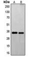 Fas Apoptotic Inhibitory Molecule 2 antibody, GTX55195, GeneTex, Western Blot image 