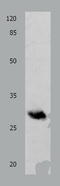 Proopiomelanocortin antibody, TA323529, Origene, Western Blot image 