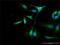 OXA1L Mitochondrial Inner Membrane Protein antibody, H00005018-D01P, Novus Biologicals, Immunocytochemistry image 