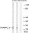 Trafficking Protein Particle Complex 3 antibody, TA315364, Origene, Western Blot image 