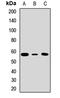 Polypyrimidine Tract Binding Protein 1 antibody, LS-C667971, Lifespan Biosciences, Western Blot image 