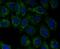 Proteasome Activator Subunit 1 antibody, A04638-1, Boster Biological Technology, Immunocytochemistry image 