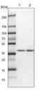 Zinc Finger DHHC-Type Containing 20 antibody, PA5-53217, Invitrogen Antibodies, Western Blot image 