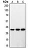 Ring Finger Protein 144A antibody, MBS822010, MyBioSource, Western Blot image 