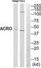 Acrosin antibody, TA313416, Origene, Western Blot image 