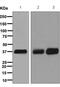 Secreted Frizzled Related Protein 1 antibody, ab126613, Abcam, Western Blot image 