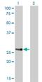 Homeobox protein Hox-A7 antibody, H00003204-M01, Novus Biologicals, Western Blot image 