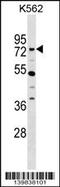 Zinc Finger Protein 133 antibody, 60-300, ProSci, Western Blot image 