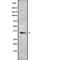 Beta-sarcoglycan antibody, PA5-67971, Invitrogen Antibodies, Western Blot image 