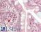 Histone Deacetylase 9 antibody, LS-B10810, Lifespan Biosciences, Immunohistochemistry paraffin image 