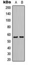 Fli-1 Proto-Oncogene, ETS Transcription Factor antibody, orb74351, Biorbyt, Western Blot image 