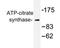 ATP Citrate Lyase antibody, AP20289PU-N, Origene, Western Blot image 