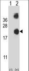 Destrin, Actin Depolymerizing Factor antibody, LS-C167547, Lifespan Biosciences, Western Blot image 