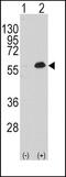 Myocyte Enhancer Factor 2C antibody, GTX81913, GeneTex, Western Blot image 