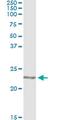 Copper Metabolism Domain Containing 1 antibody, MA5-24555, Invitrogen Antibodies, Immunoprecipitation image 