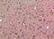 Growth Differentiation Factor 5 antibody, A01356-1, Boster Biological Technology, Immunohistochemistry frozen image 