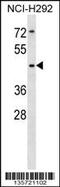 Sialic Acid Binding Ig Like Lectin 14 antibody, 58-450, ProSci, Western Blot image 