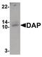 Death Associated Protein antibody, PA5-34564, Invitrogen Antibodies, Western Blot image 