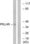 Prolactin-releasing peptide receptor antibody, abx015471, Abbexa, Western Blot image 