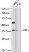 Ribosomal Protein L5 antibody, 18-425, ProSci, Western Blot image 