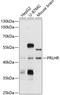 Prolactin Releasing Hormone Receptor antibody, 13-676, ProSci, Western Blot image 