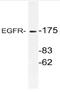 EGFR antibody, AP21102PU-N, Origene, Western Blot image 